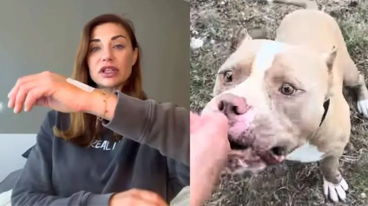 « Moi Nuggets est toujours en laisse » : La colère d’Ariane Brodier mordue par un chien